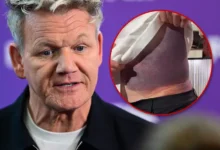 Gordon Ramsay Bike Accident