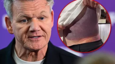 Gordon Ramsay Bike Accident