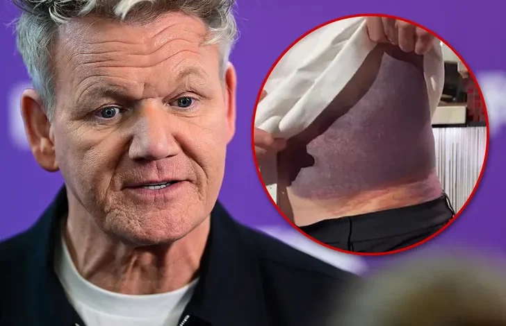 Gordon Ramsay Bike Accident